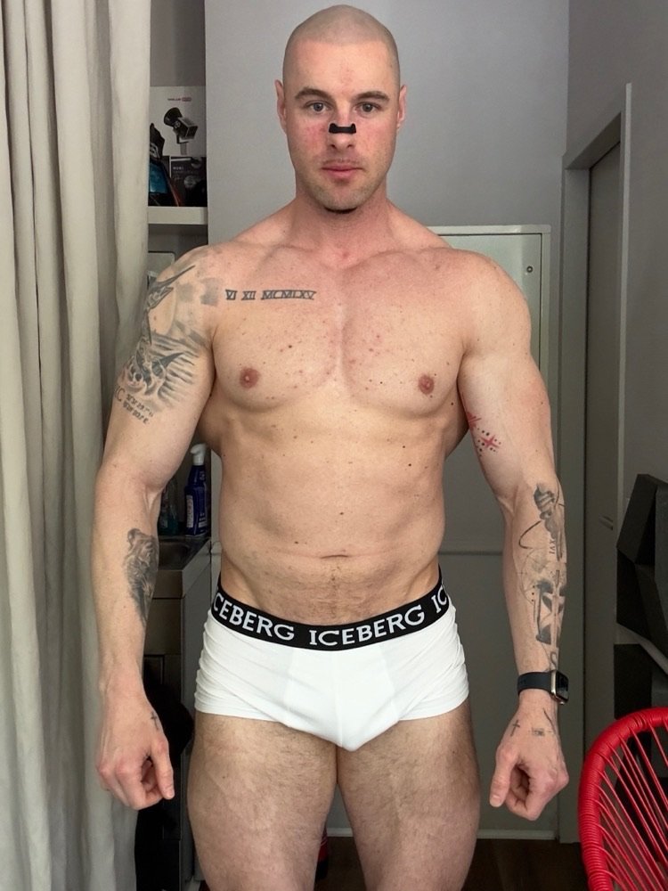 Kevin – vorher